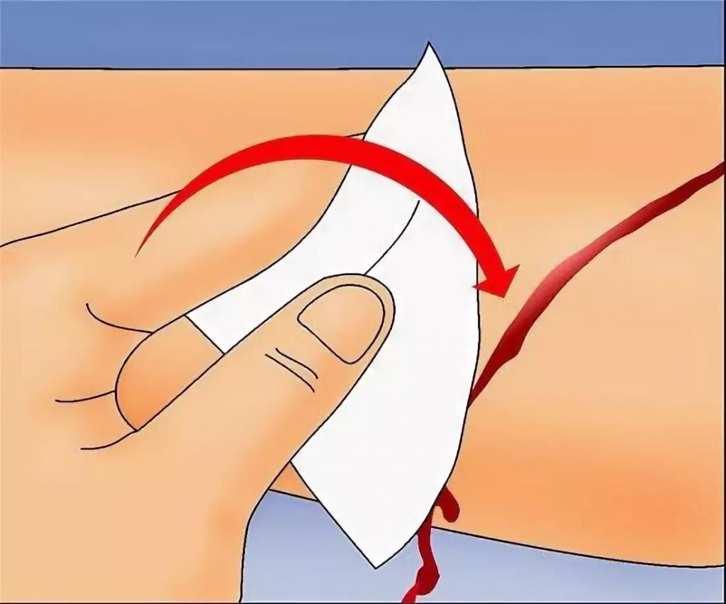 Как остановить кровь в домашних условиях: простые и эффективные методы